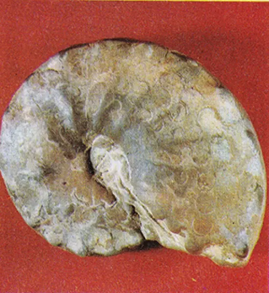<p>Ceratites nodosus, triassico. Fonte: Enciclopedia Universo. Istituto Geografoco De Agostini, Novara 1971</p>